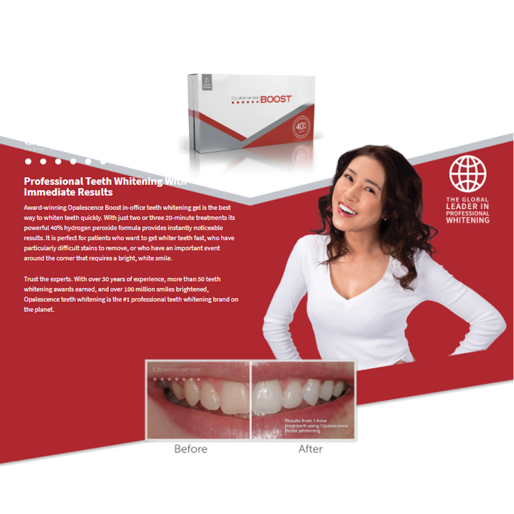 Teeth Whitening Opalescence - Opalescence Boost 40% PF American Ultradent