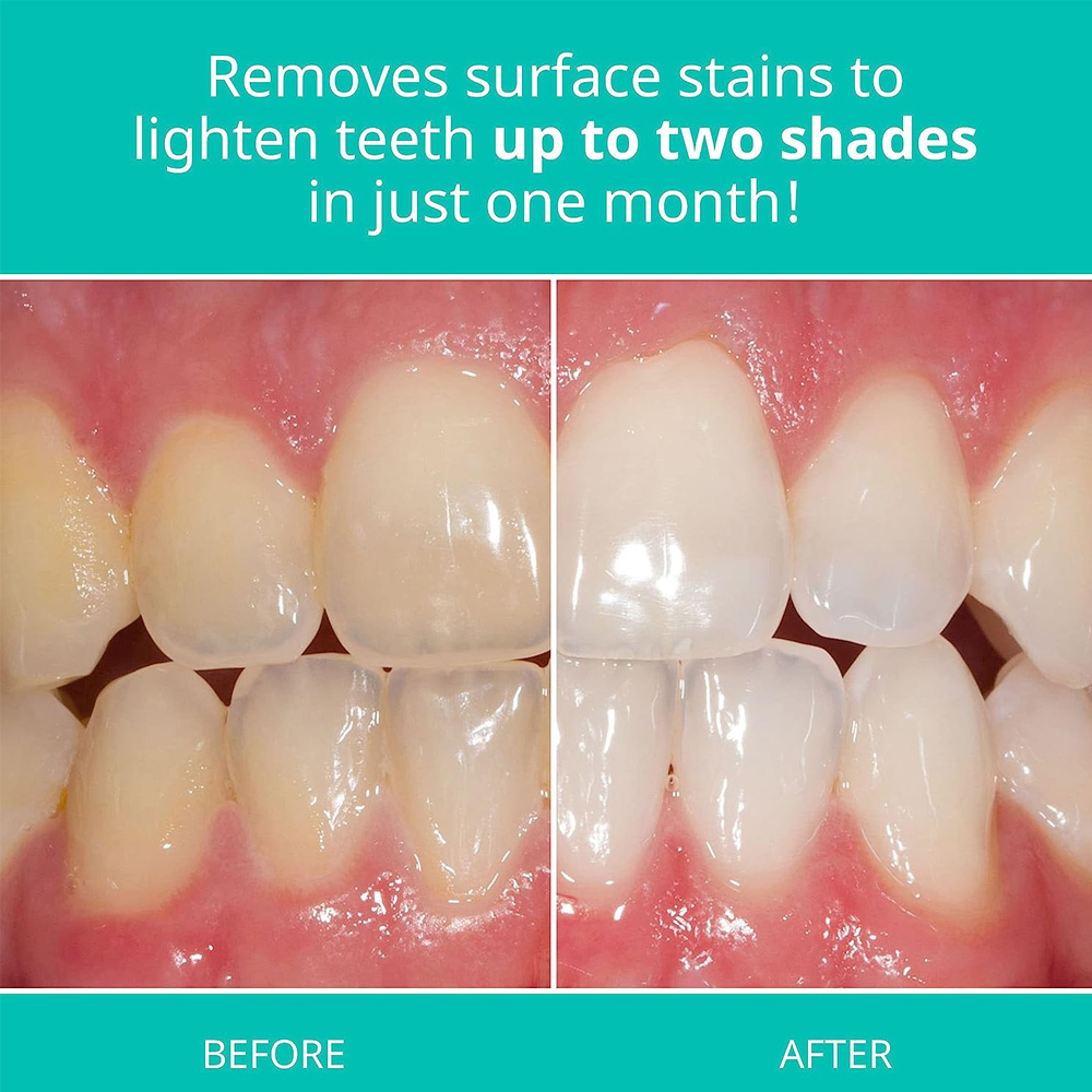Pasta gigi pemutih opalesens u - Teeth Whitening Opalescence ulasan dan harga