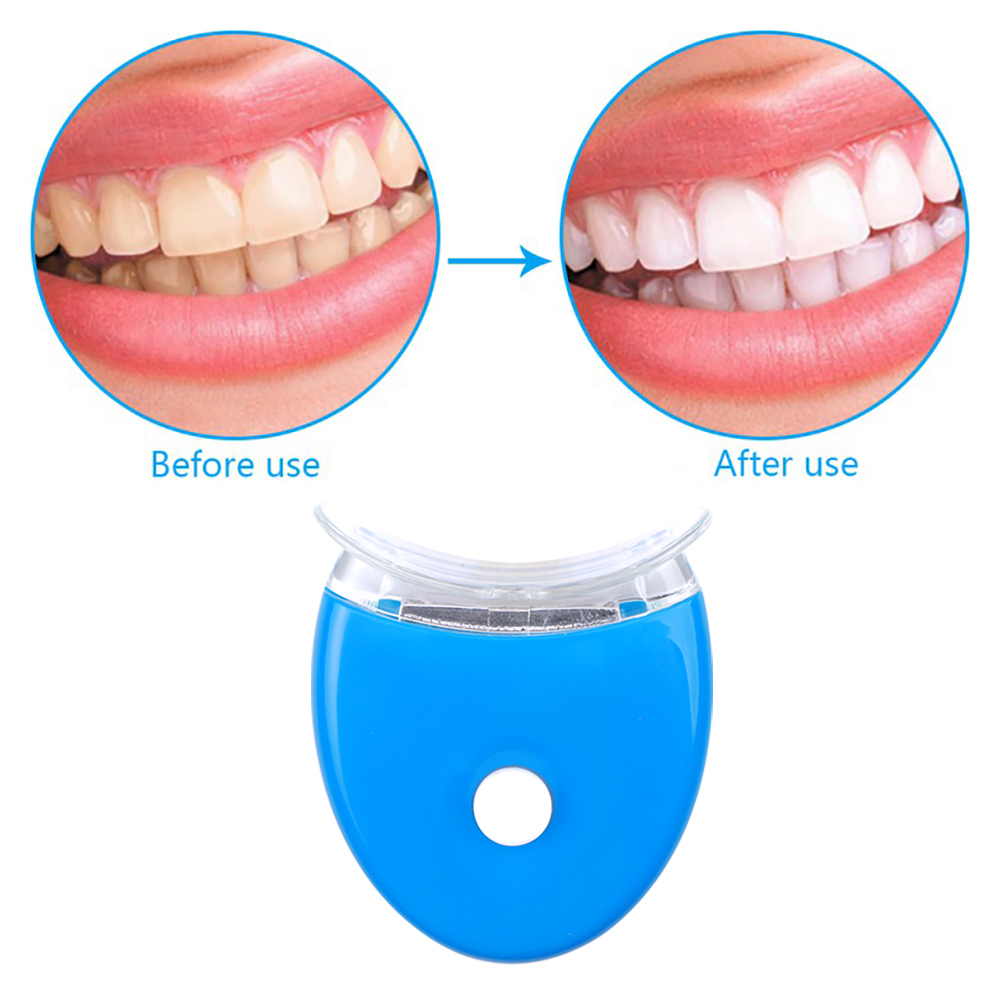 Kit Gel pemutih gigi, alat keb - Teeth Whitening Opalescence ulasan dan harga