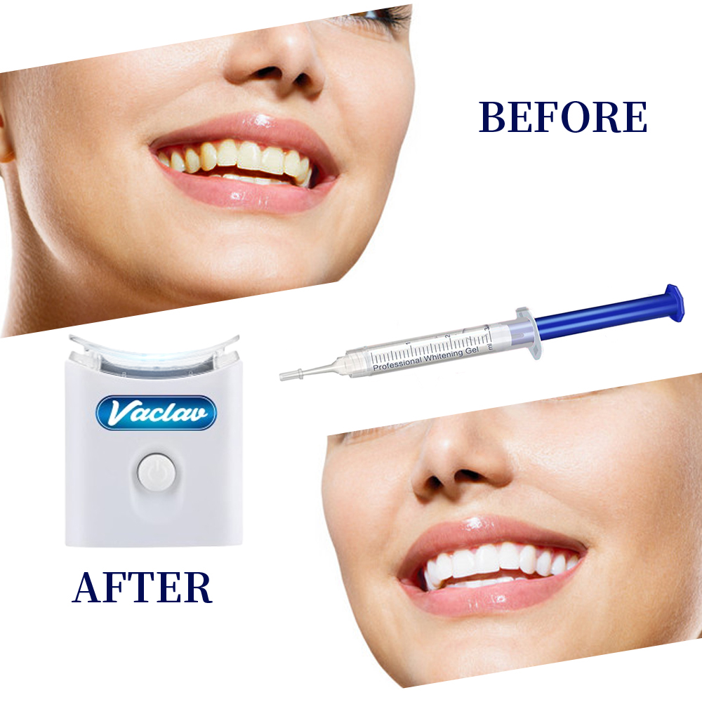 Kit Pemutih Gigi di Rumah deng - Teeth Whitening Opalescence ulasan dan harga