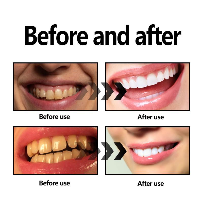 Bubuk Arang Bambu Pemutih Gigi - Teeth Whitening Filter ulasan dan harga