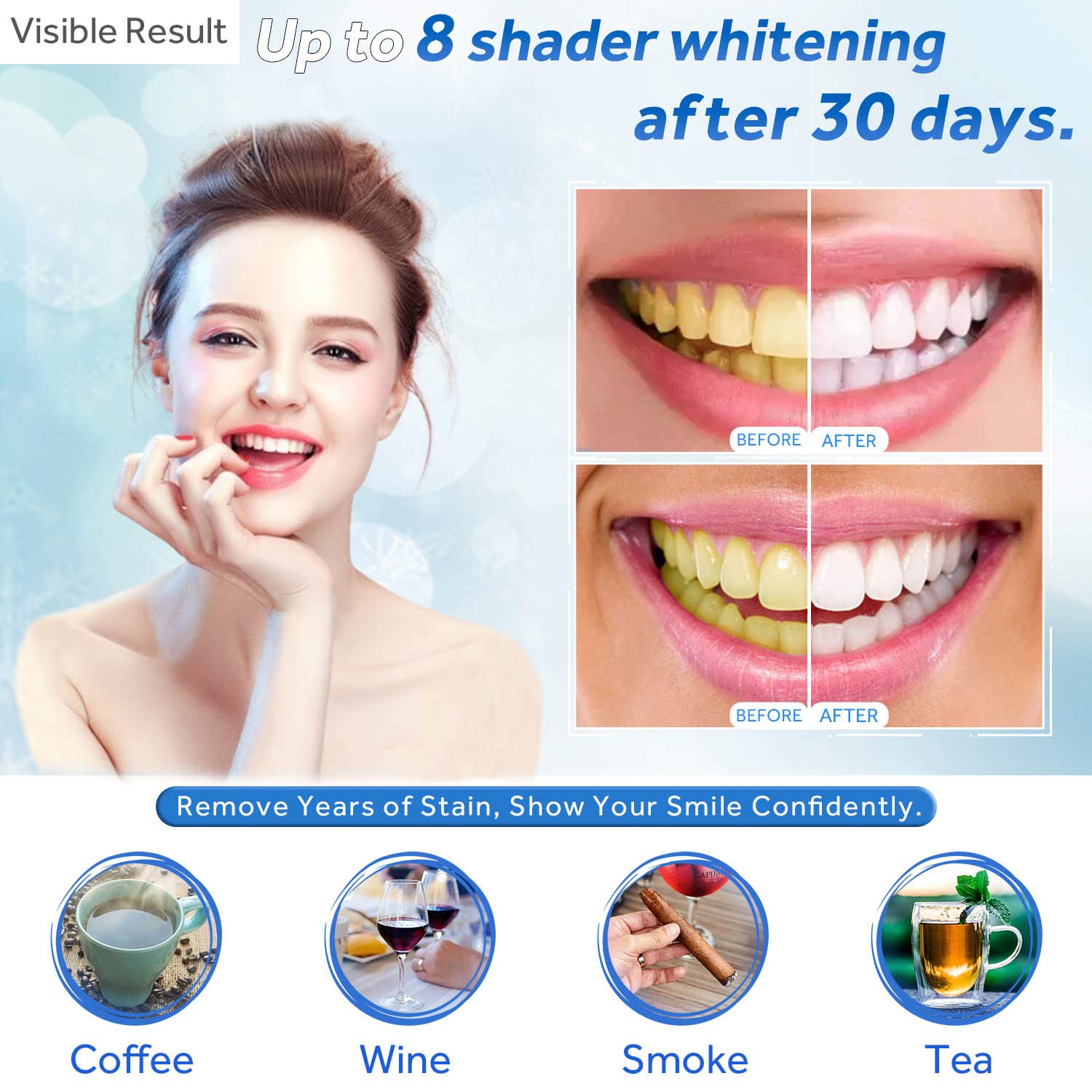 Gel Pemutih Gigi Isi Ulang Syr - Teeth Whitening Opalescence ulasan dan harga