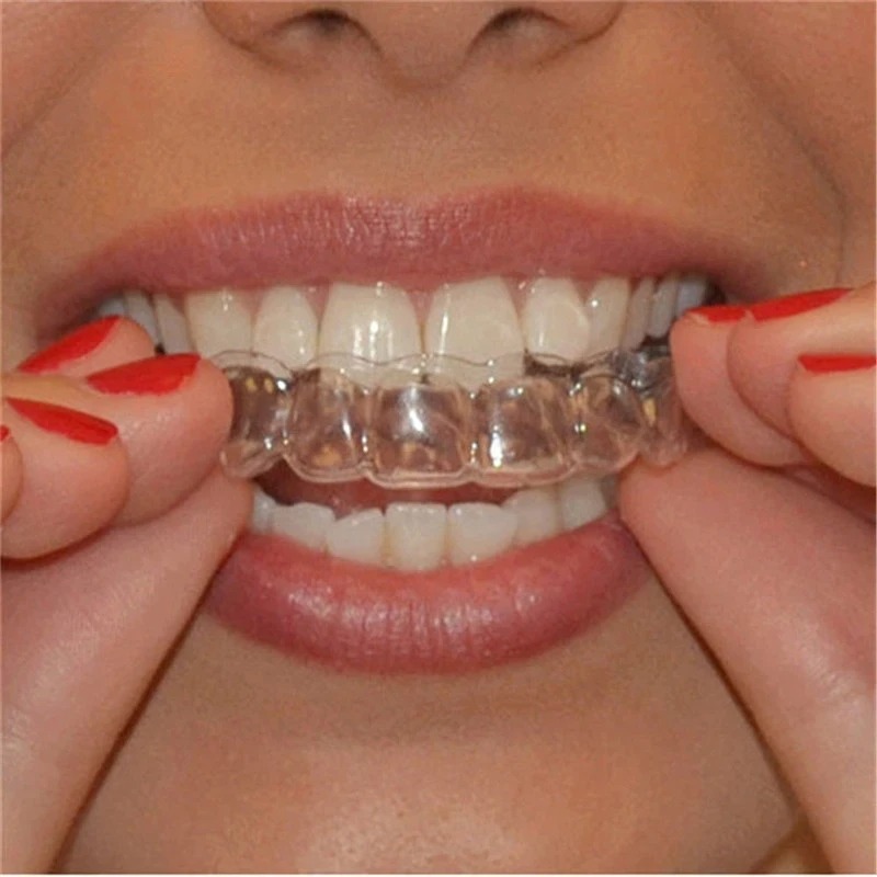 Pelindung mulut tidur Anti men - Dental Guard Night ulasan dan harga