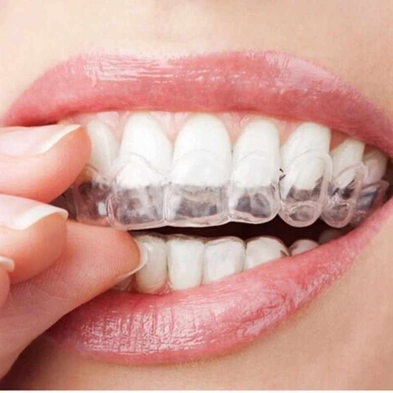 Pelindung mulut tidur Anti men - Dental Guard Night ulasan dan harga