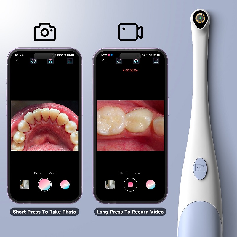 Kamera Endoskop Oral 1440P Fot - Teeth Whitening Video ulasan dan harga