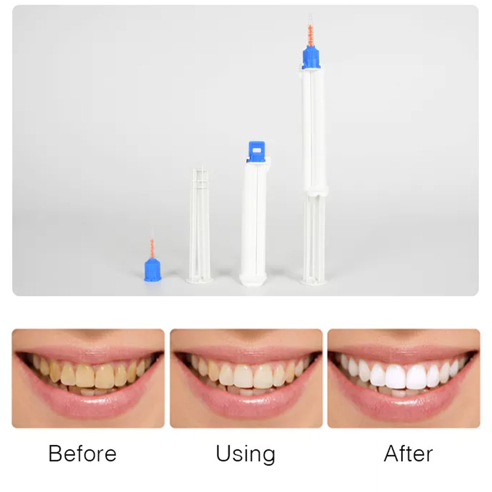 10/5/2 Buah Jarum Suntik Gigi  - Teeth Whitening Opalescence ulasan dan harga