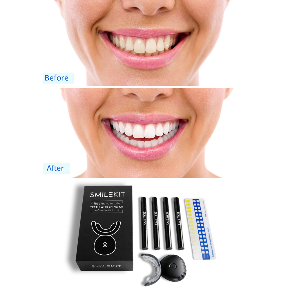 LED Pemutih Gigi Elektrik Baru - Teeth Whitening Led Kit ulasan dan harga