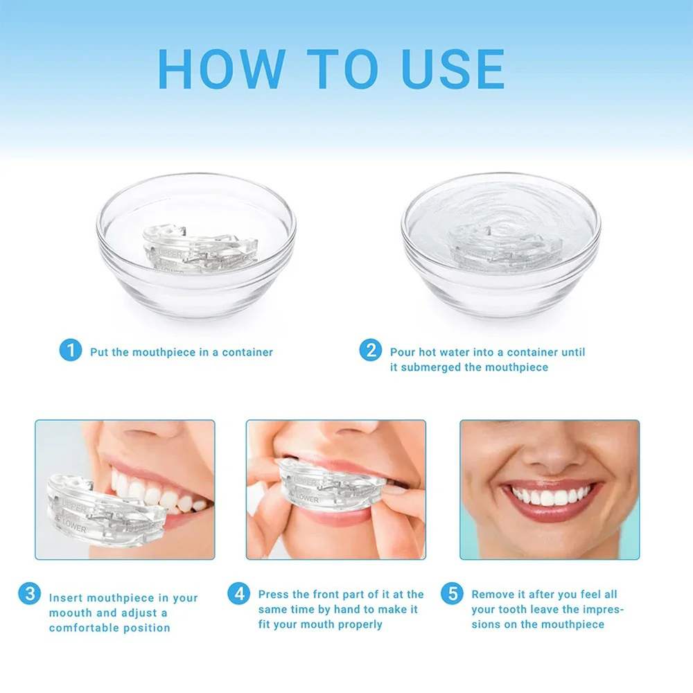 1/2/3/4/5 Buah, Pelindung Mulu - Dental Guard Night ulasan dan harga