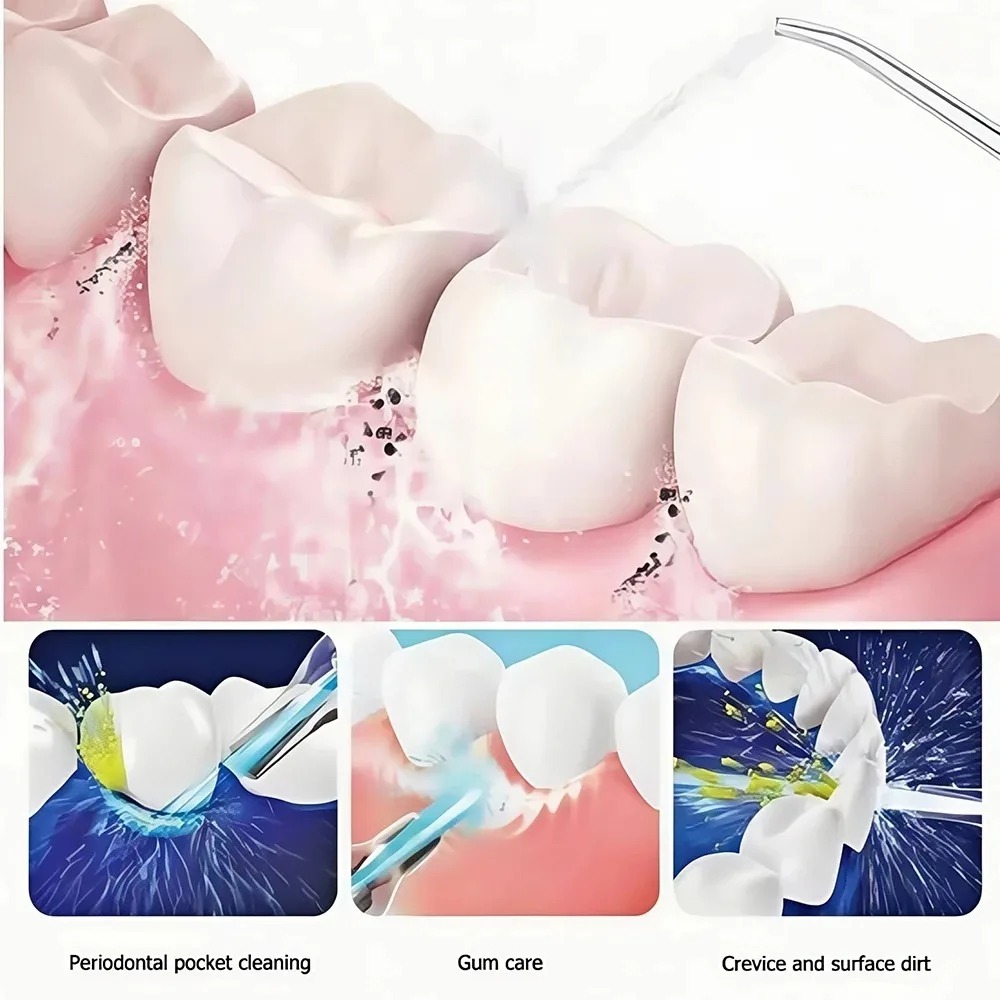Alat Semprot Air Gigi Portabel - Water Flosser Cordless ulasan dan harga