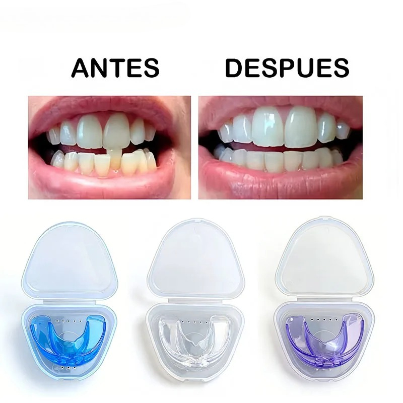 1 Buah Pelindung Gigi Malam Ha - Dental Guard Night ulasan dan harga